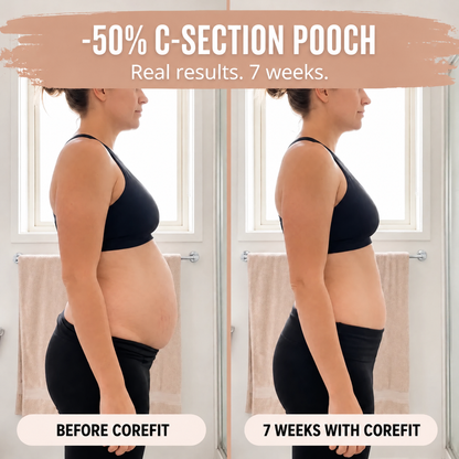 Postpartum Support Brief Corefit - CRF-US