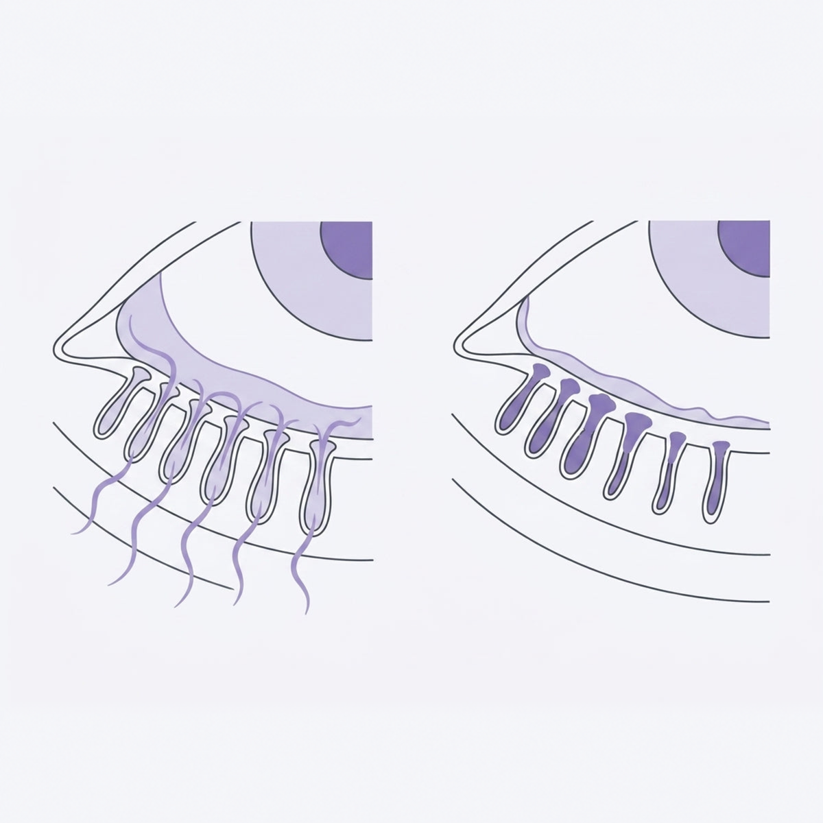 Masque vapeur pour les yeux secs Brumeo - BRM-CA