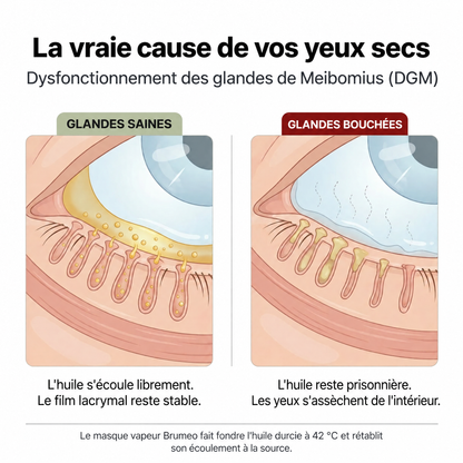 Masque vapeur pour les yeux secs Brumeo - BRM-CA